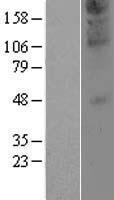 ZDHHC21 Human Over-expression Lysate