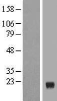 SRARP Human Over-expression Lysate