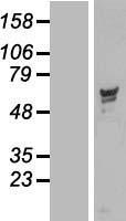 PPP2R5D Human Over-expression Lysate