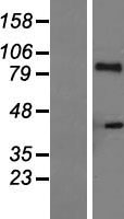 IL21 Receptor (IL21R) Human Over-expression Lysate