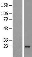 ARL5B Human Over-expression Lysate