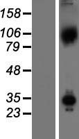 Axin 1 (AXIN1) Human Over-expression Lysate