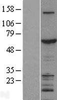 ZGPAT Human Over-expression Lysate