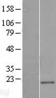 CD300E Human Over-expression Lysate