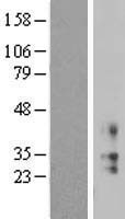KCNMB2 Human Over-expression Lysate