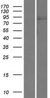 HIPK1 Human Over-expression Lysate