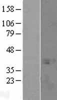 SPT3 (SUPT3H) Human Over-expression Lysate