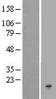 CKLF Human Over-expression Lysate