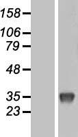 Uridine Phosphorylase 1 (UPP1) Human Over-expression Lysate