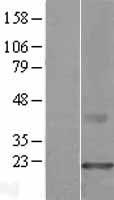 CMTM3 Human Over-expression Lysate
