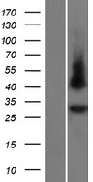 GJE1 (GJC3) Human Over-expression Lysate
