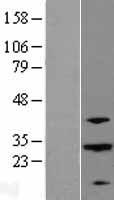 ABHD12B Human Over-expression Lysate