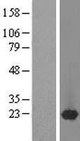 DARPP32 (PPP1R1B) Human Over-expression Lysate