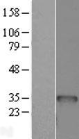 BCDIN3D Human Over-expression Lysate