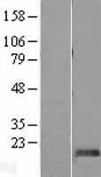 DPH4 (DNAJC24) Human Over-expression Lysate