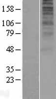 GPR136 (OPN5) Human Over-expression Lysate