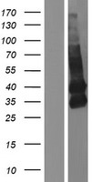 TMEM119 Human Over-expression Lysate