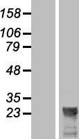 NCRNA00174 (LINC00174) Human Over-expression Lysate