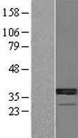 HSD11B1 Human Over-expression Lysate