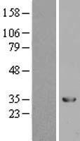 H1T2 (H1FNT) Human Over-expression Lysate