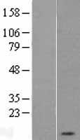 PKI alpha (PKIA) Human Over-expression Lysate