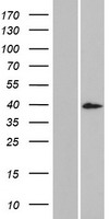 DCDC1 Human Over-expression Lysate