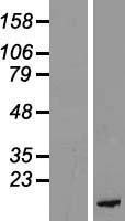 PKIB Human Over-expression Lysate