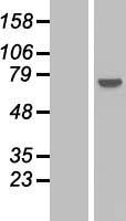 PPP2R3A Human Over-expression Lysate