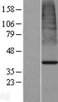 ACOT7 Human Over-expression Lysate