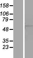 ZNF50 (ZSCAN22) Human Over-expression Lysate