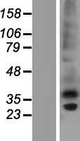 CTRP6 (C1QTNF6) Human Over-expression Lysate