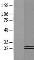 COQ6 Human Over-expression Lysate