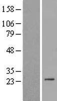 SPC24 Human Over-expression Lysate