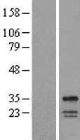 WBS28 (WBSCR28) Human Over-expression Lysate