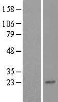 ZNF428 Human Over-expression Lysate