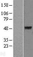 keratin 40 (KRT40) Human Over-expression Lysate