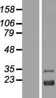 ZFAND2A Human Over-expression Lysate
