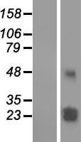 TMEM61 Human Over-expression Lysate