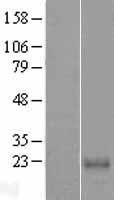 Calcium binding protein 7 (CABP7) Human Over-expression Lysate