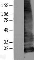 LHFPL5 Human Over-expression Lysate