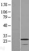 VSTM2A Human Over-expression Lysate