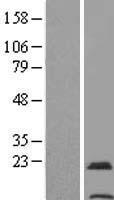 TMEM31 Human Over-expression Lysate