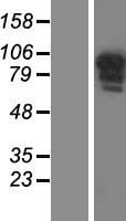 CCDC144B Human Over-expression Lysate
