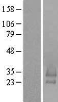 C16orf79 (BRICD5) Human Over-expression Lysate