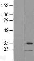 TMPRSS12 Human Over-expression Lysate