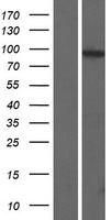 WDR27 Human Over-expression Lysate