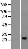 SPATA46 Human Over-expression Lysate