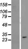 CYB561D1 Human Over-expression Lysate