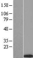 LINC00303 Human Over-expression Lysate