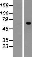 ACSM2B Human Over-expression Lysate